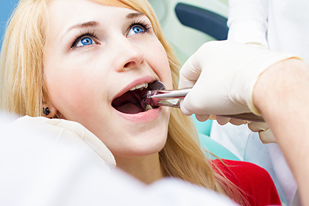 Richwood Family Dental | Dental Bridges, Dental Sealants and Night Guards